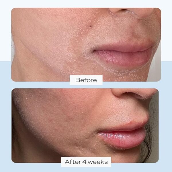 First Aid Beauty Ultra Repair Cream Intense Hydration Moisturizer for Face and Body - Image 3
